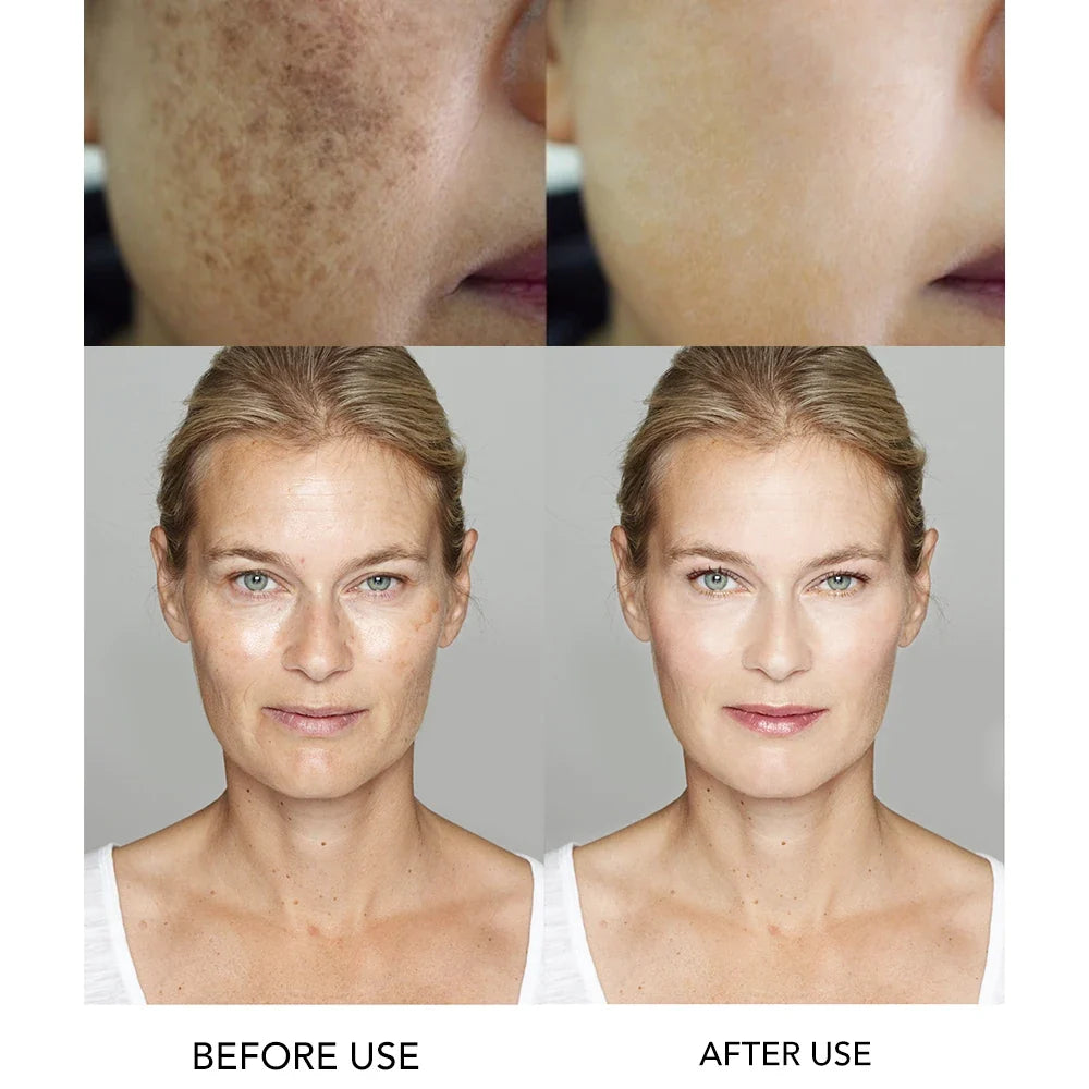AILKE Amino Acid Whitening Facial Cleanser, Deeply Clean Skin, Reduce Dark Spots, Stains, Oil Control, Anti Acne, Blackheads