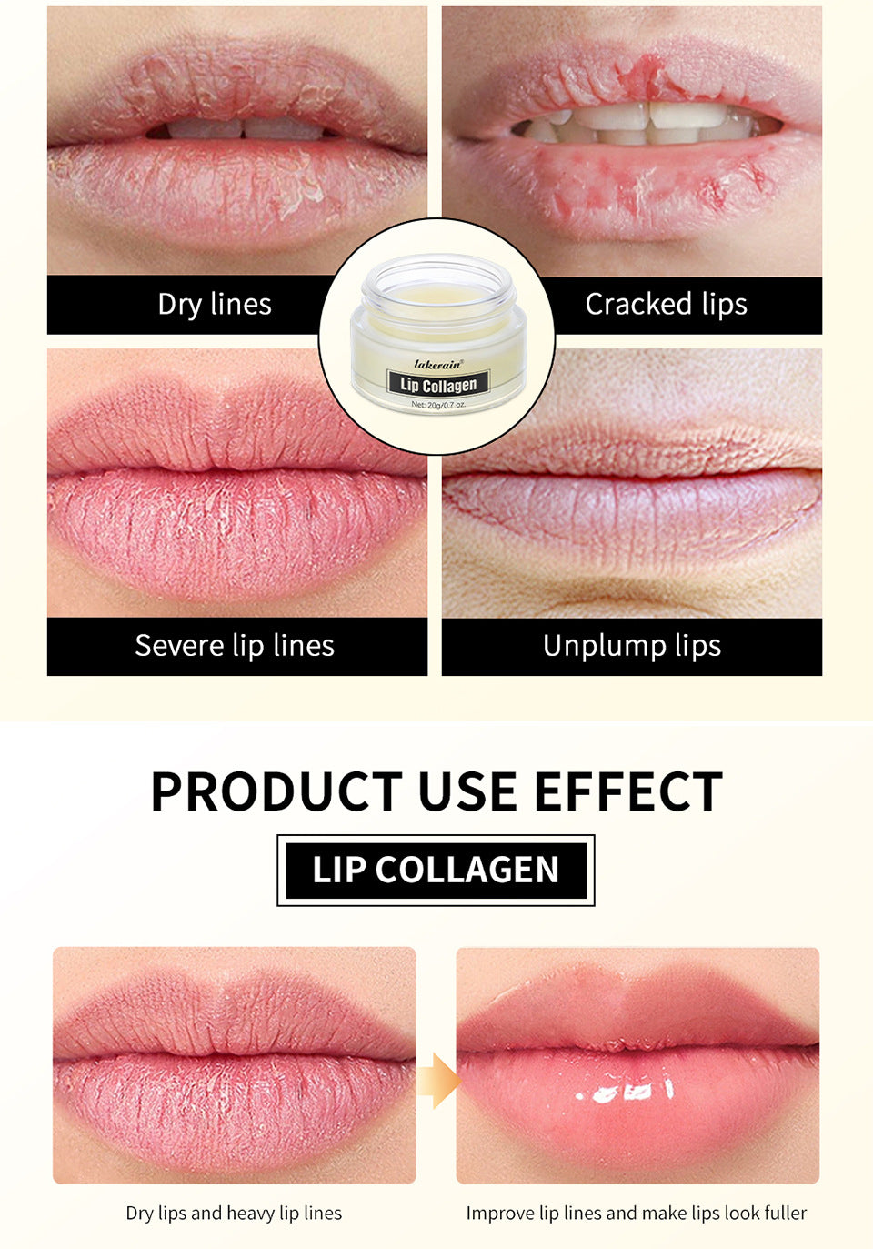 Collagen Lip Mask,Autumn and Winter Lip Moisturizing, Deep Moisturizing Overnight Lip Balm Lip Plumper for Dry Repair Lip Care