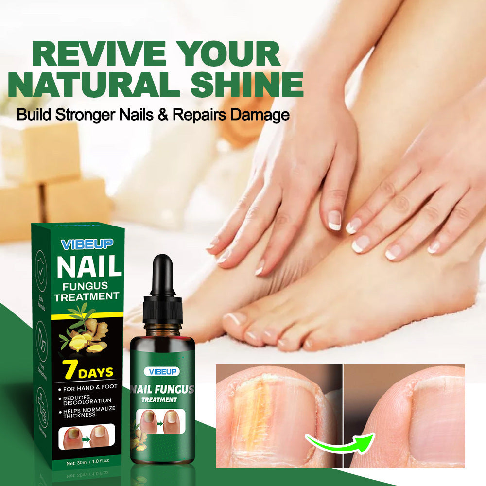 7 Days Fungal Nail Treatment Serum Foot Nail Fungus Removal Repair Gel Anti Infection Paronychia Onychomycosis Foot Nails Care