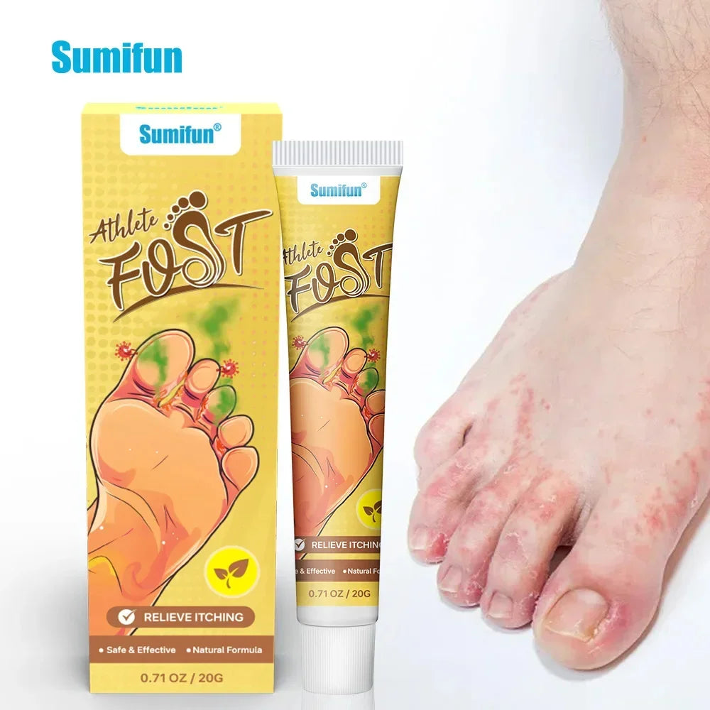 Anti-Foot Fungus Ointment Deodorant Care Products Foot Deodorant Creams Antiseptic and Antiperspirant Foot Skin Topical Cream