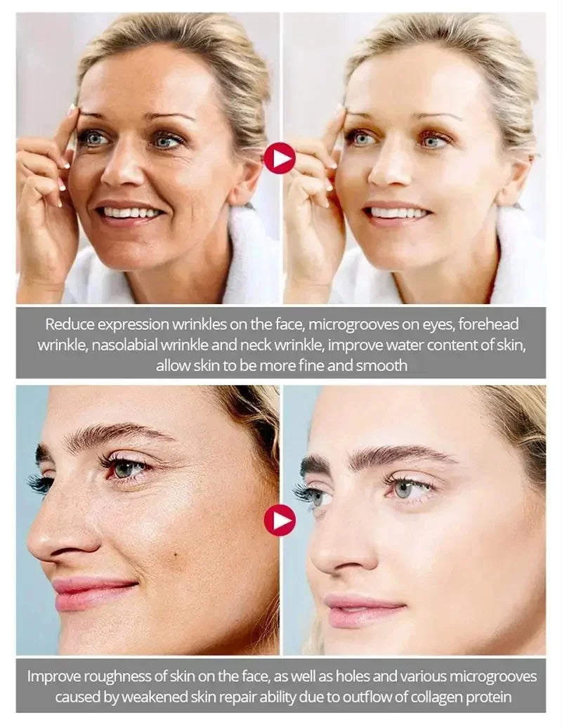 Bee Venom Anti-Aging Cream Rejuvenate face Skin Deep Moisturizing Fade Lines Fast Absorption Repair Instant Wrinkle Skincare