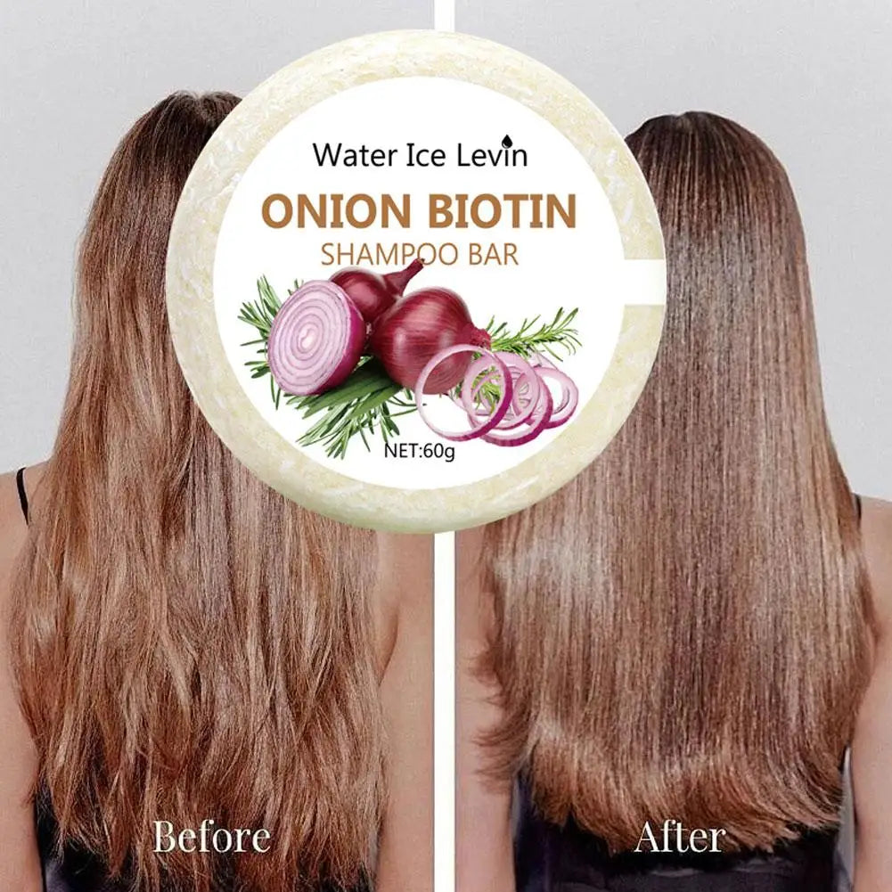 55g/60g Onion Rosemary Shampoo Soap, Handmade Soap Oil Control And Dandruff Removal Soap For Both Men & Women