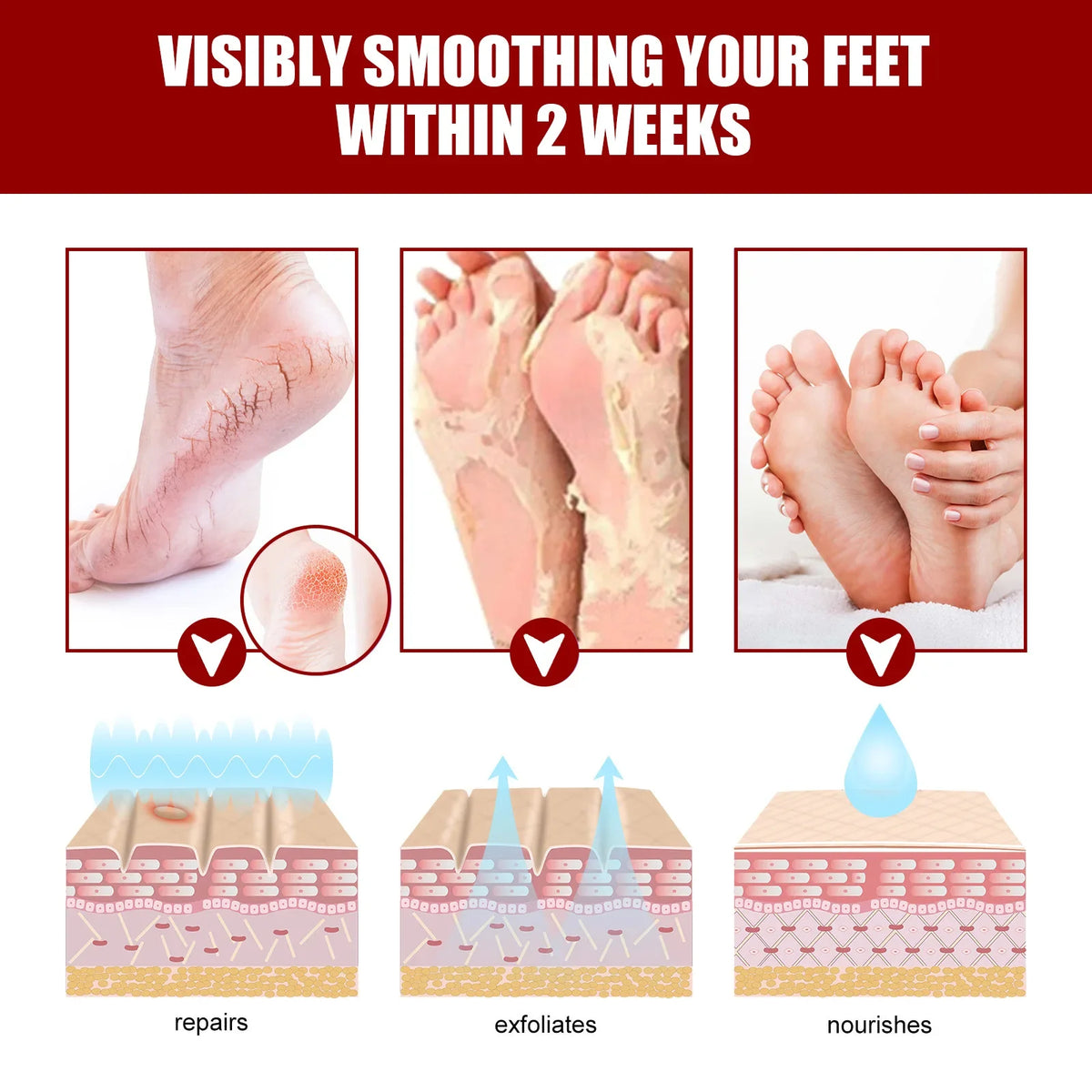 Foot Fruit Acid Exfoliating Peel Mask Dry Rough Cracked Feet, Soothing Your Feet & Heel, Make Feet Smooth And Soft Pure natural