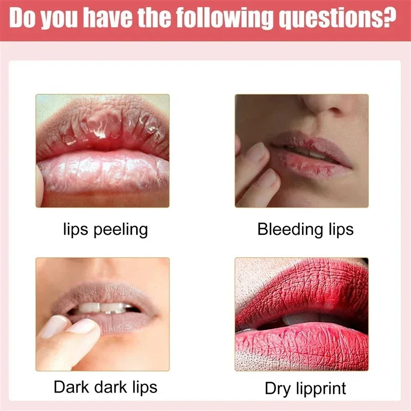 Fast Lightening Pink Mouth Lips Serum Bleaching Permanent Remove Dark Smoke Lips Lip Balm Moisturize Gloss Lipstick Lip Oil