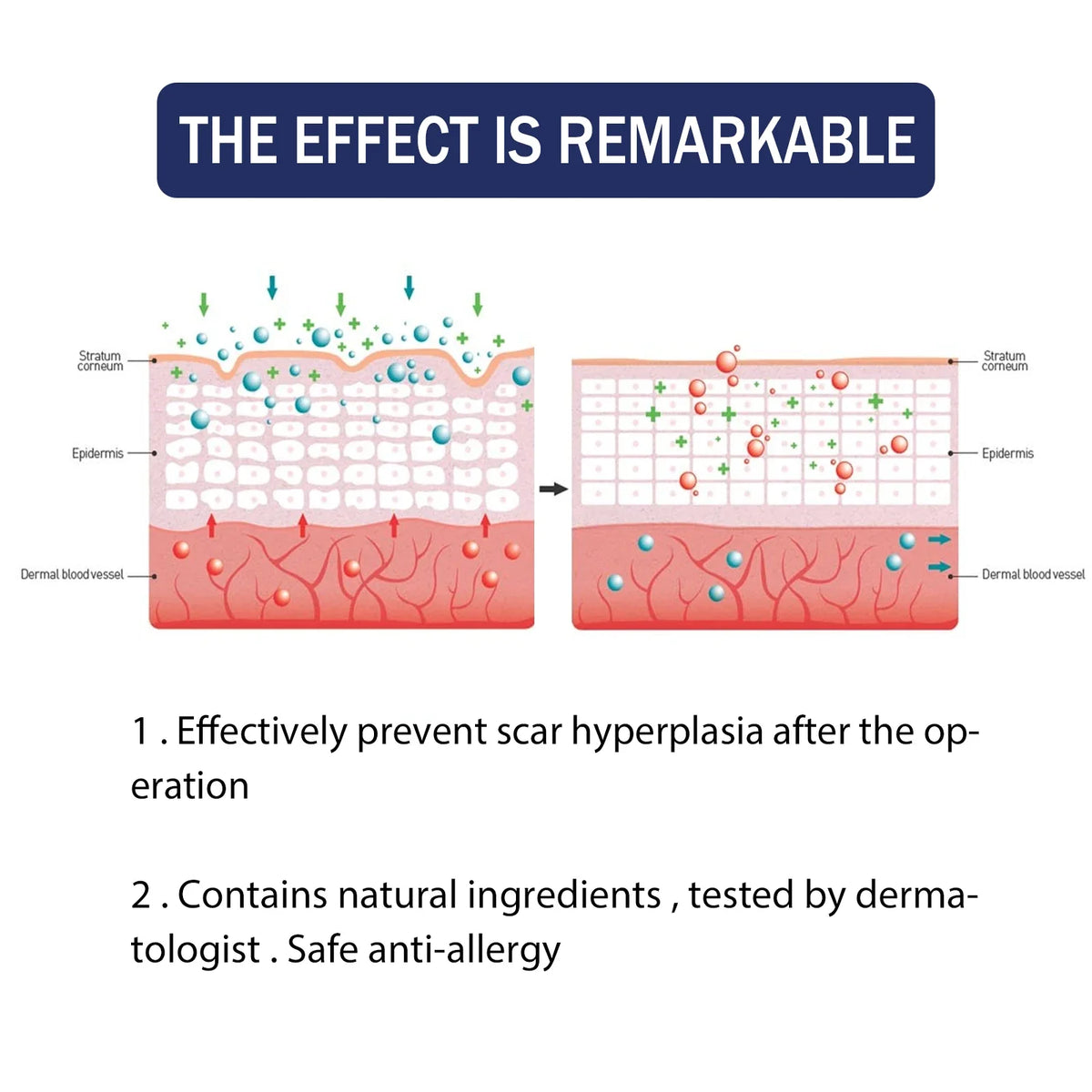 EELHOE Silicone Skin Scar Gel Retinol Niacinamide Scars Stretch Marks Burn Marks Deeply Nourish Skin Reduce Redness Swelling 30g