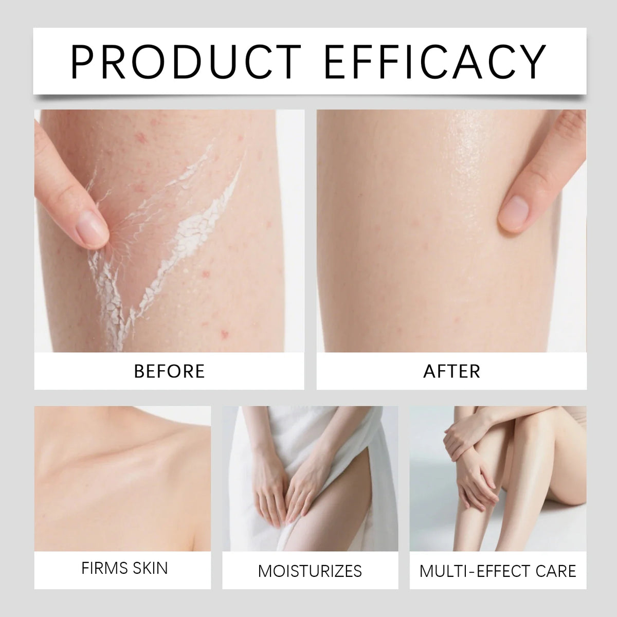 Body Keratin Care Kojic Acid Turmeric Spray Gently Exfoliating Peeling Solution Brightening Hydrating Skin Care All Skin Types