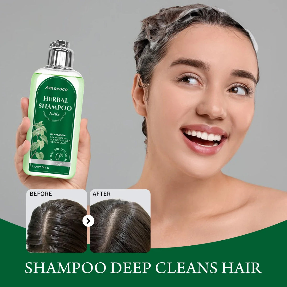 Amococo 3pcs Nettle Shampoo 220ml Each Oil Balancing Daily Hair Cleanser for Oily Normal Hair Purifying Scalp Care Gentle Formula