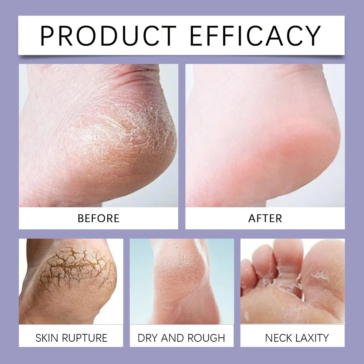 Exfoliating Foot Scrub with Bamboo Charcoal Sea Salt Dead Skin Removal Soften Feet Skin Deep Cleansing Feet Smoothing Care