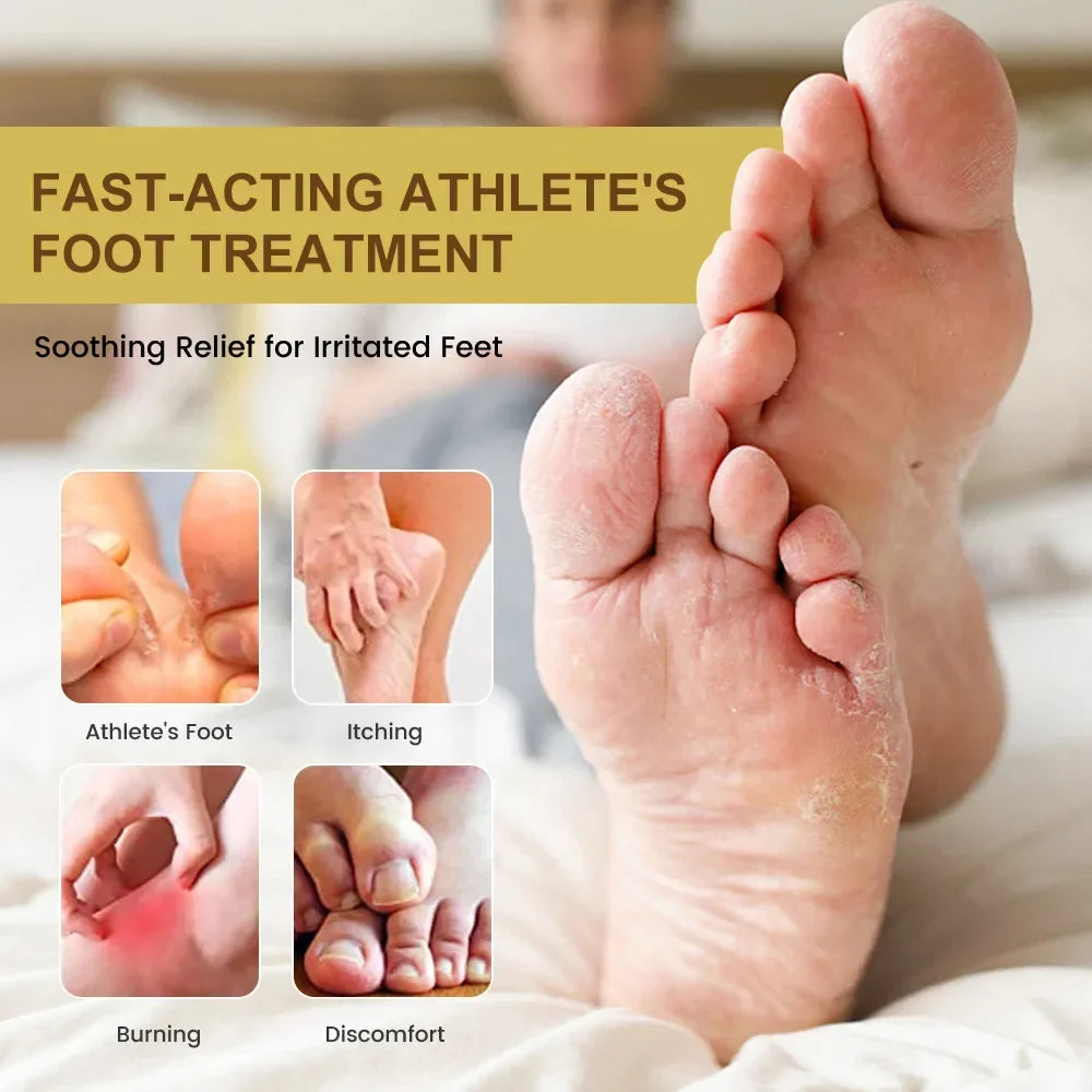 Anti-Foot Fungus Ointment Deodorant Care Products Foot Deodorant Creams Antiseptic and Antiperspirant Foot Skin Topical Cream