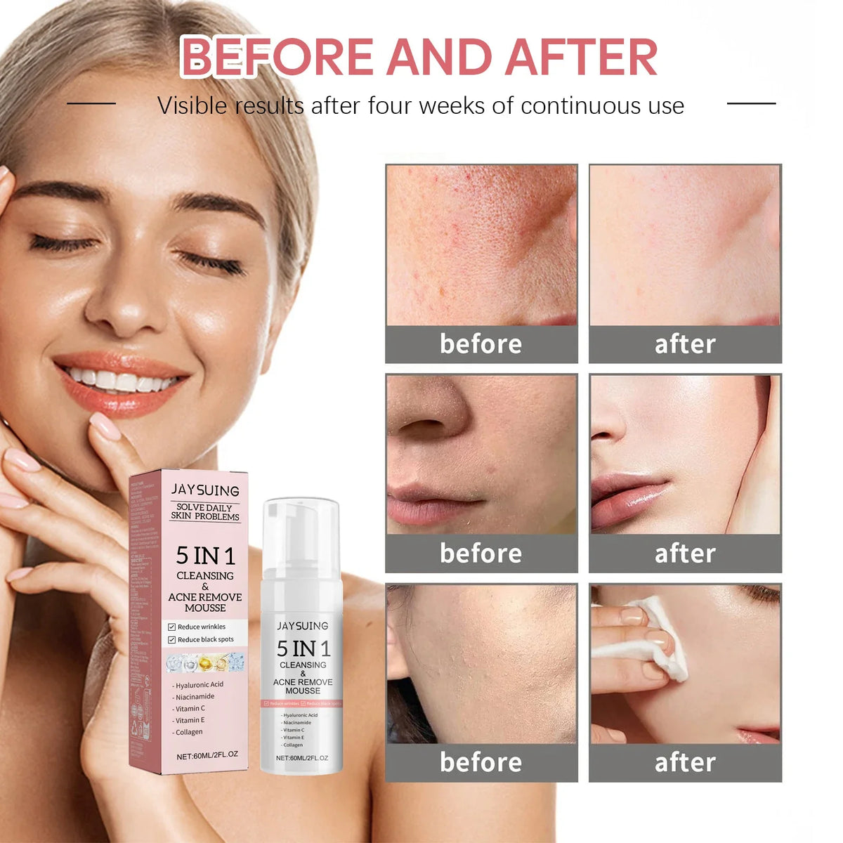 5 in 1 Facial Cleansing Mousse Hyaluronic Acid Hydrating Foam Cleanser Pore Shrink Pores Moisturizing korea Face Skin Care