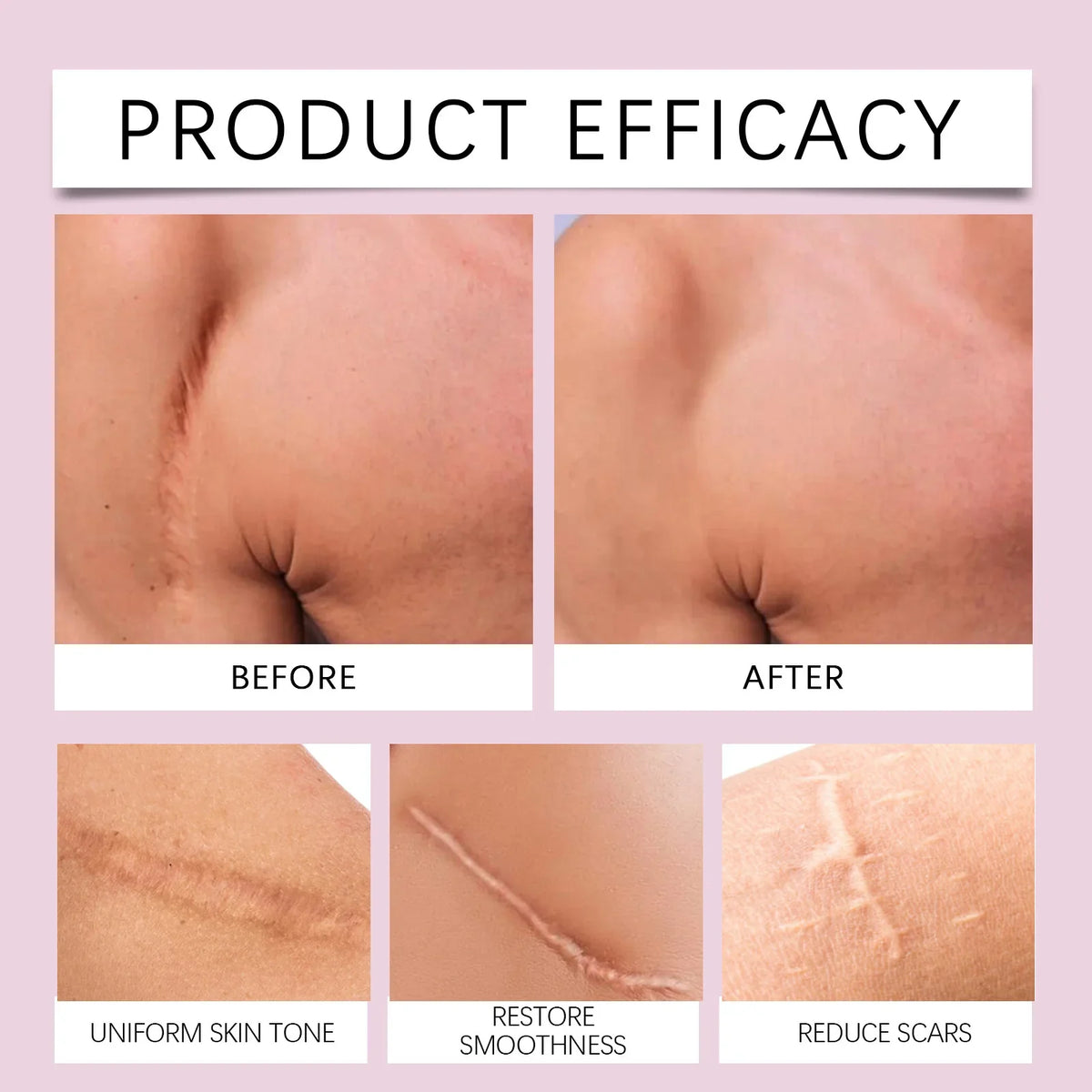 Collagen Scar Tape for Face, Silicone Wrinkle Patches, Invisible Gel Sheets for Fine Lines, Scar Concealer for Smooth Skin