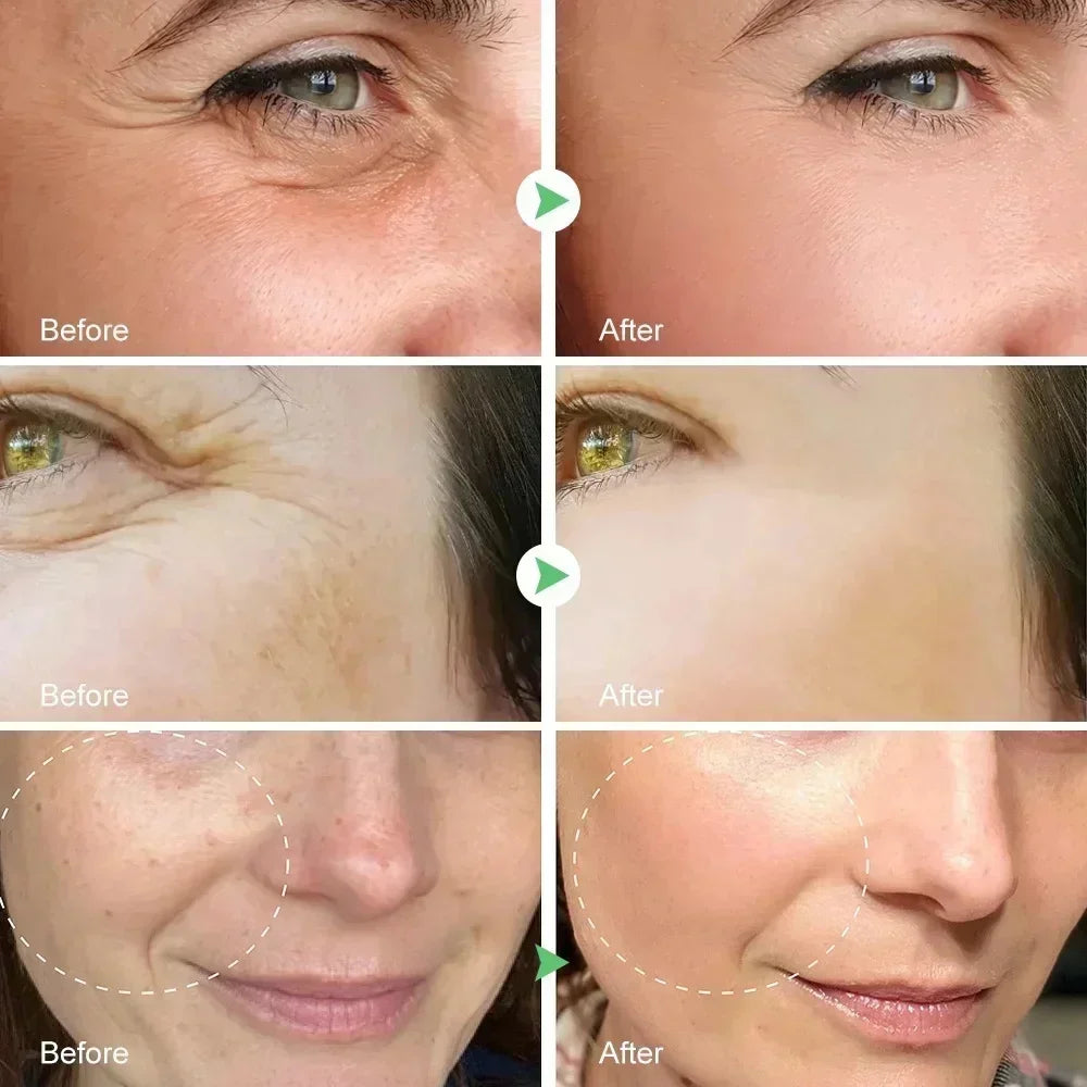 Bee Venom Anti-Aging Cream Rejuvenate face Skin Deep Moisturizing Fade Lines Fast Absorption Repair Instant Wrinkle Skincare