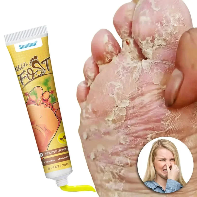 Anti-Foot Fungus Ointment Deodorant Care Products Foot Deodorant Creams Antiseptic and Antiperspirant Foot Skin Topical Cream