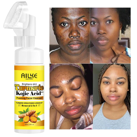 AILKE Brightening Foaming Facial Cleanser, With Natural Turmeric, Kojic Acid, Remove Makeup Residue and Acne, Clean Skin,160 ml
