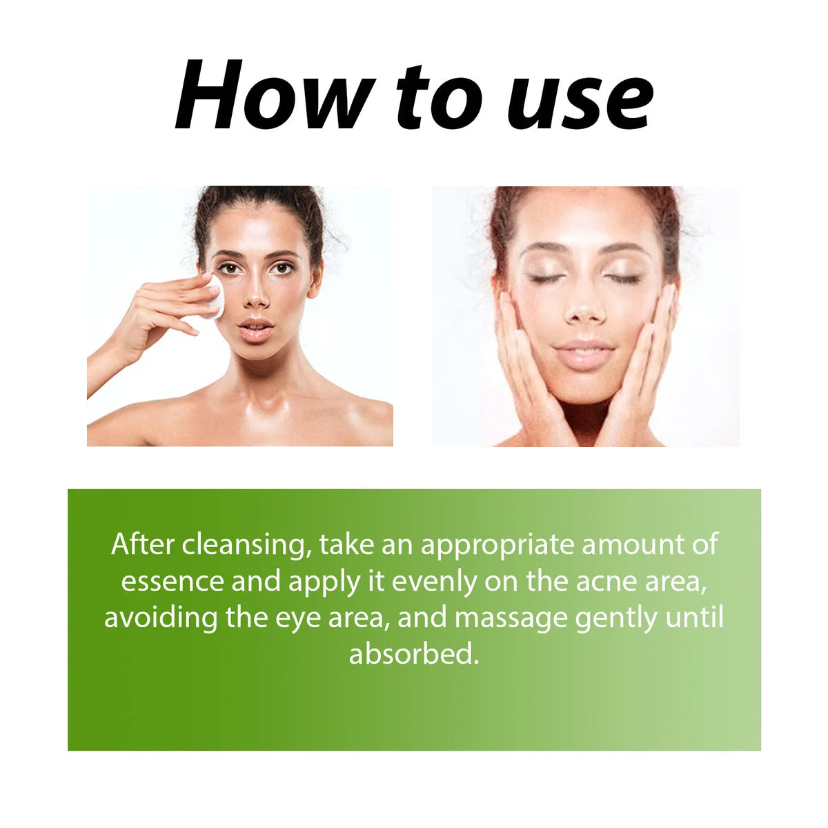 Acne Face Cream Pimple Treatment Oil Control Repair Redness Remove Blackhead Smooth Hydrating Moisturizing Pore Shrinking Serum