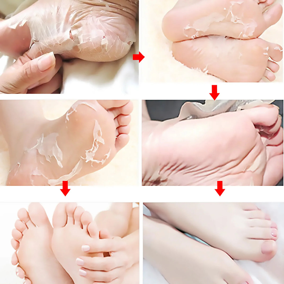 Foot Fruit Acid Exfoliating Peel Mask Dry Rough Cracked Feet, Soothing Your Feet & Heel, Make Feet Smooth And Soft Pure natural