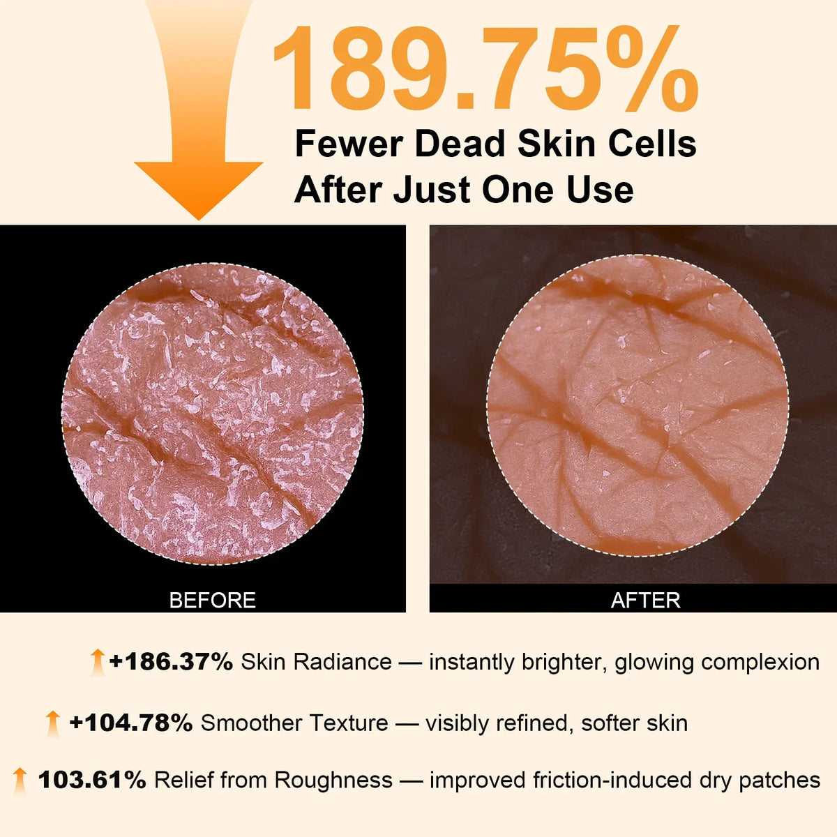 Body Keratin Care Kojic Acid Turmeric Spray Gently Exfoliating Peeling Solution Brightening Hydrating Skin Care All Skin Types