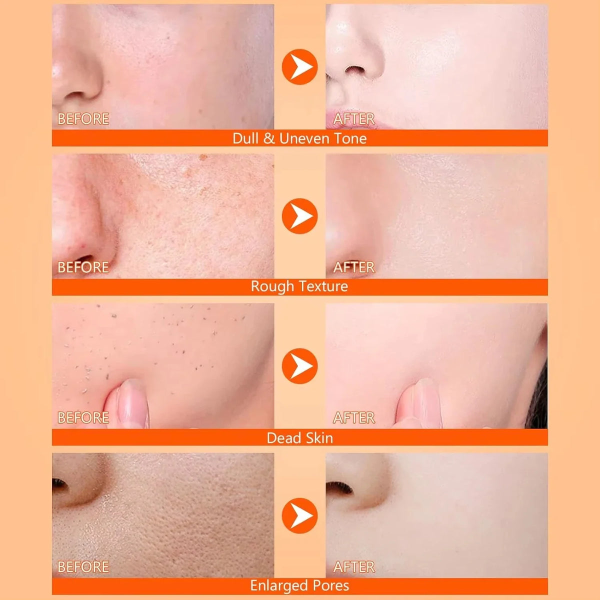 Body Keratin Care Kojic Acid Turmeric Spray Gently Exfoliating Peeling Solution Brightening Hydrating Skin Care All Skin Types