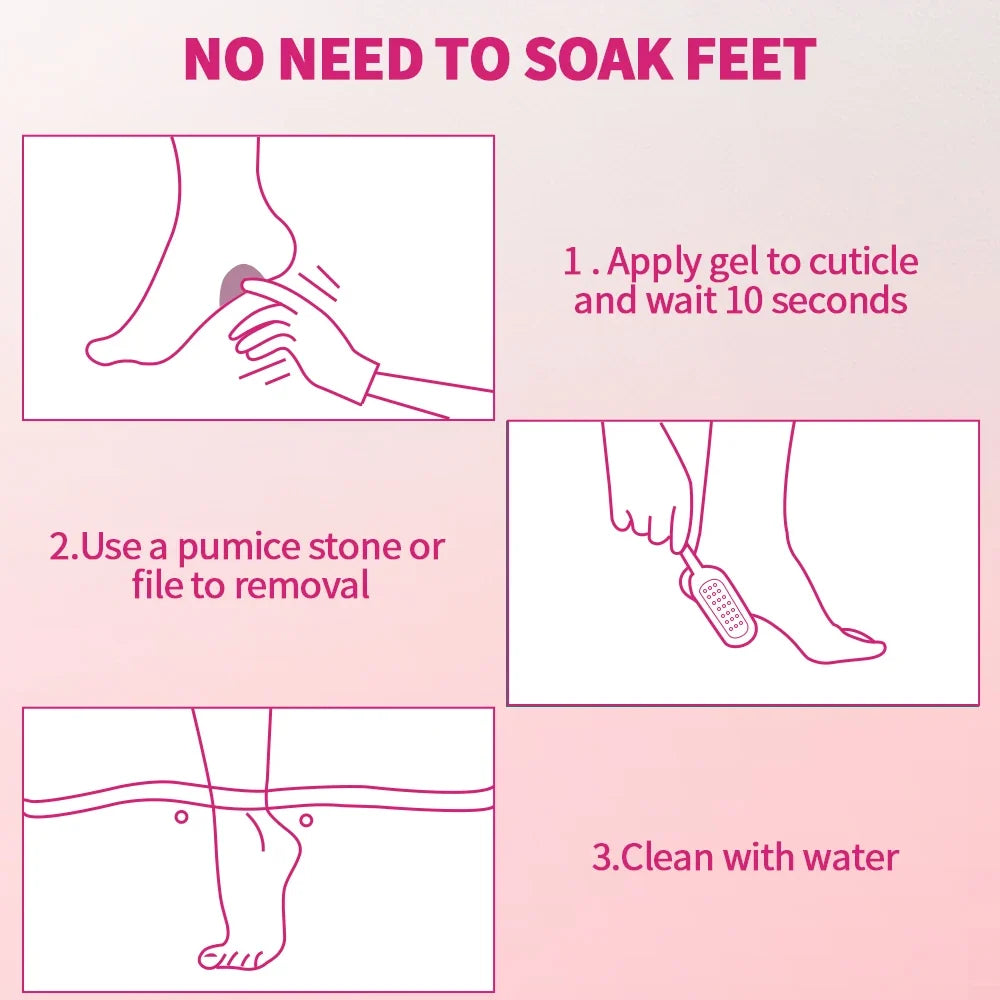 Gorgellux Foot Care Callus Softening Set Callus Removal Gel and Foot Scrub Set For Dry Rough Cracked Heels  Foot Exfoliating