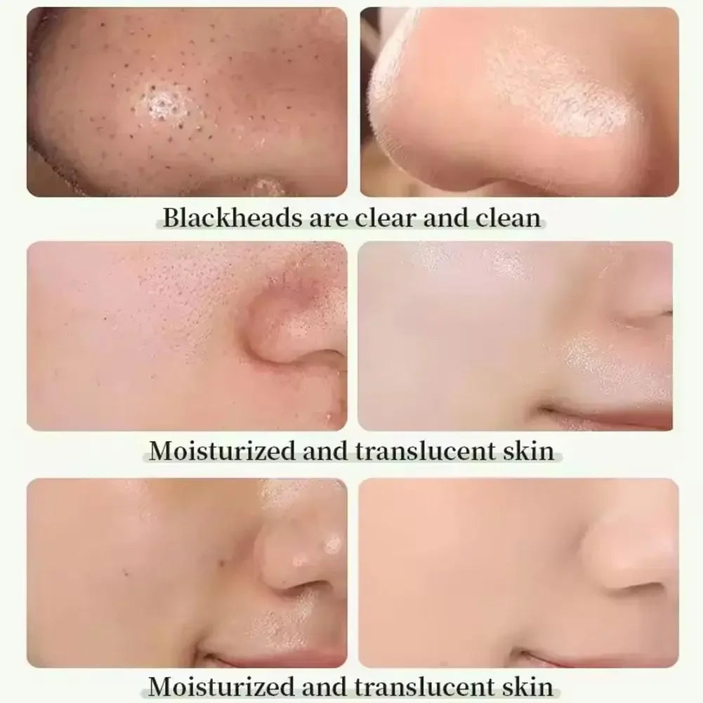 Green Tea Eggplant Solid Mask Deep Cleansing Oil Control Balance Antioxidan Shrink Pores Remove Blackheads Refreshing  Mud Mask