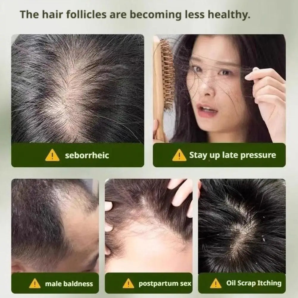 Anti-Hair Loss Shampoo Bar 120g, Herbal Usma Biotin Soap for Hair Growth, Strengthening Broken Hair, Control Oil & Dandruff
