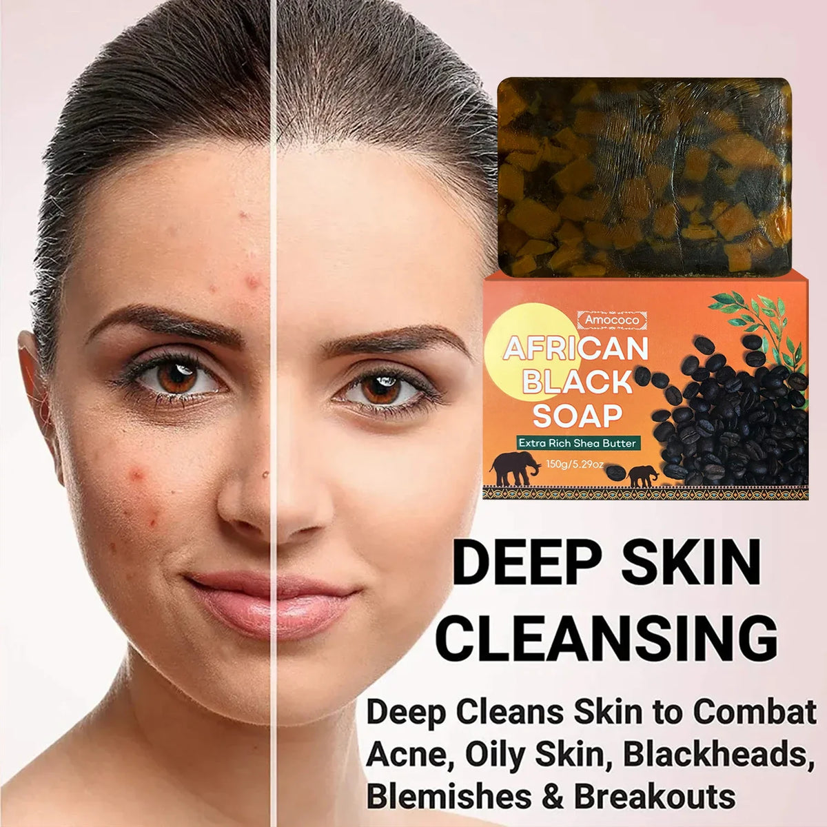 Amococo 3/6pcs African Black Soap Bar 150g Shea Butter Body Soap Moisturizing Cleansing Bath Soap with Coconut Oil Caffeine Neem Extract Natural Skin Care Soap for Men Women Dry Skin