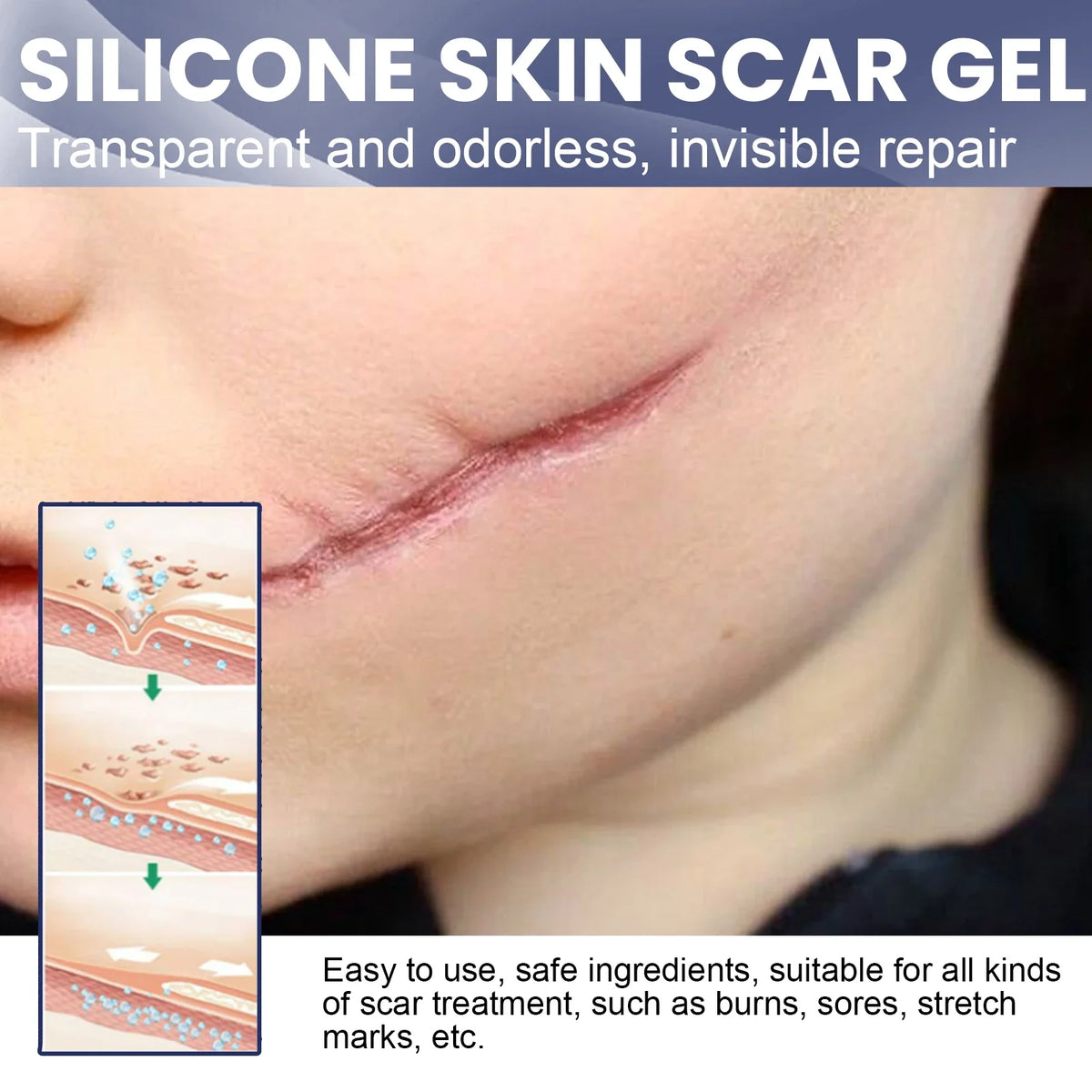 EELHOE Silicone Skin Scar Gel Retinol Niacinamide Scars Stretch Marks Burn Marks Deeply Nourish Skin Reduce Redness Swelling 30g