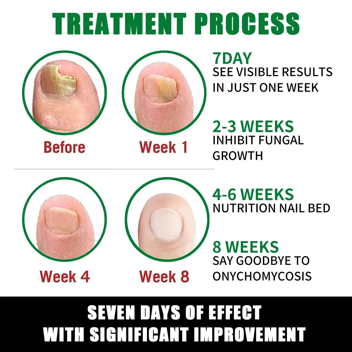 7 Days Fungal Nail Treatment Serum Foot Nail Fungus Removal Repair Gel Anti Infection Paronychia Onychomycosis Foot Nails Care