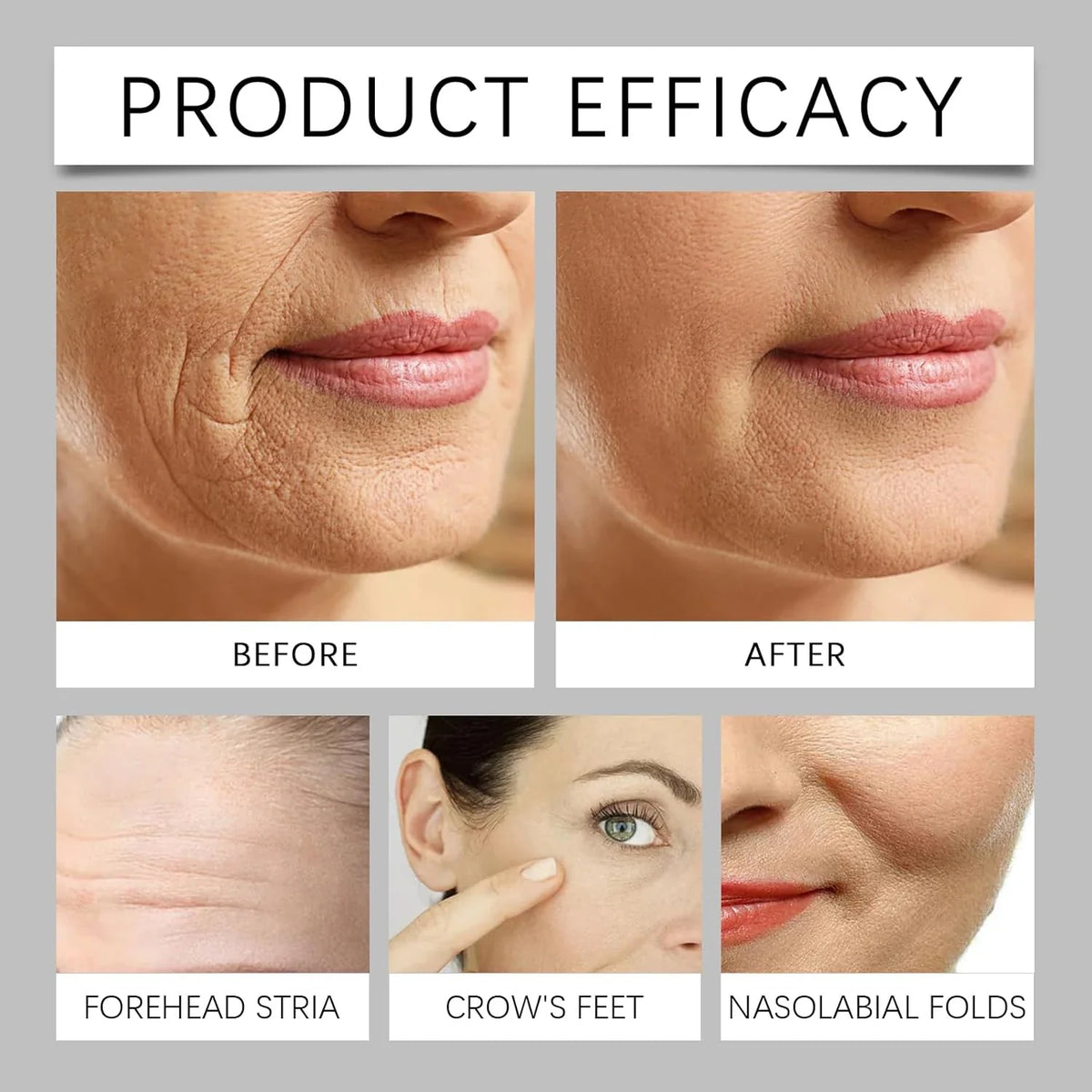 Botax Bliss Elixir Anti-Aging Cream: Bee Venom/Retinol, Moisturizing & Firming, Reclaims Youthful Vibrancy