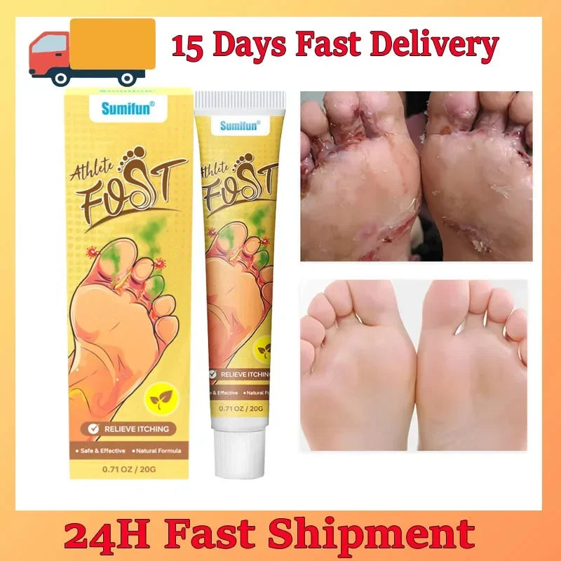 Anti-Foot Fungus Ointment Deodorant Care Products Foot Deodorant Creams Antiseptic and Antiperspirant Foot Skin Topical Cream