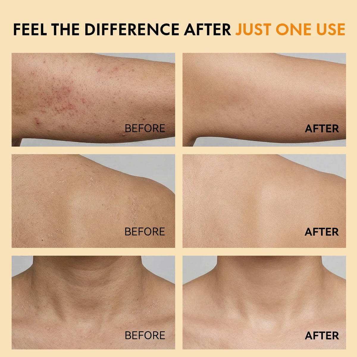 Body Keratin Care Kojic Acid Turmeric Spray Gently Exfoliating Peeling Solution Brightening Hydrating Skin Care All Skin Types