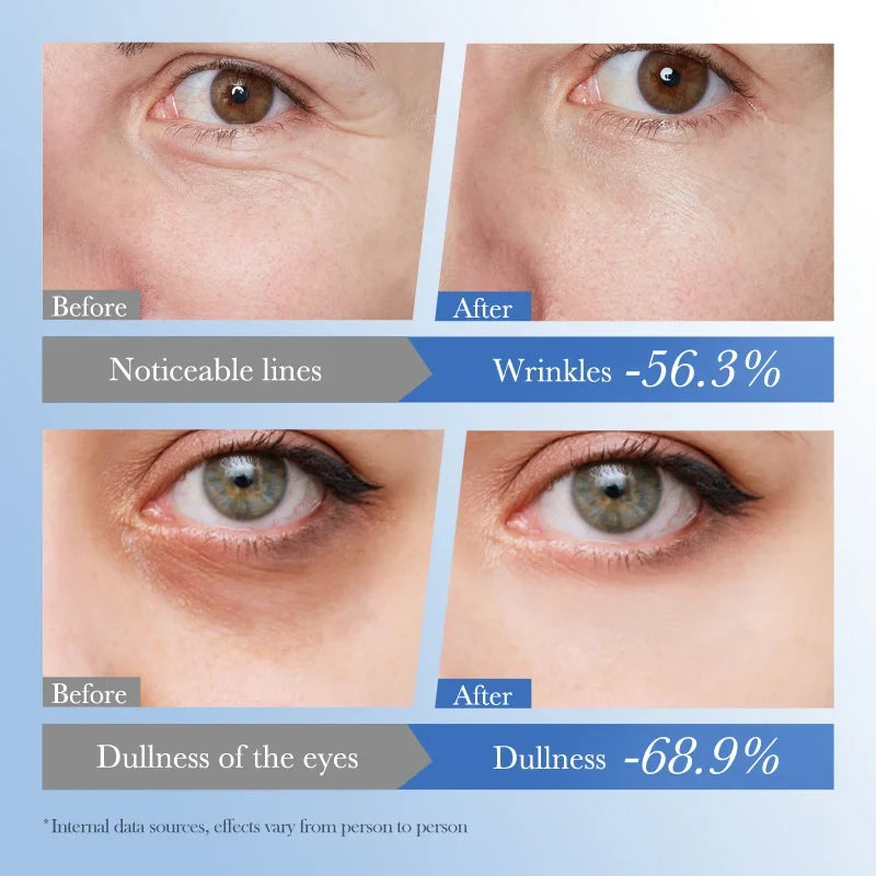 Caviar Eye Bag Removal Cream Hyaluronic Acid Anti-Wrinkle Firming Skin Fade Fine Lines Anti Dark Circle Puffiness Eye Care 20g