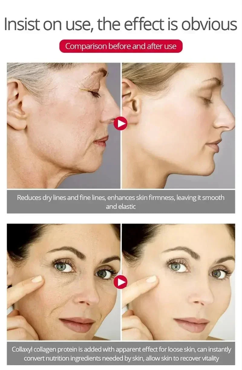 Bee Venom Anti-Aging Cream Rejuvenate face Skin Deep Moisturizing Fade Lines Fast Absorption Repair Instant Wrinkle Skincare