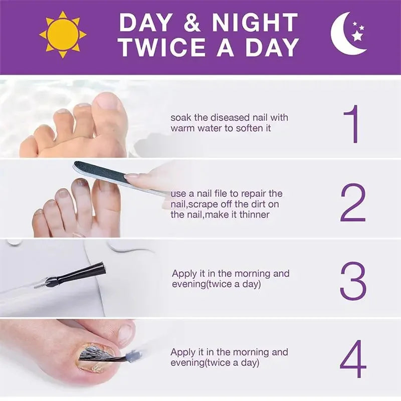 Fungal Nail Treatment Serum Nails Fungus Removal Treating Paronychia Liquid Anti Gray Nails Toe Infection Foot Repair Care Tools