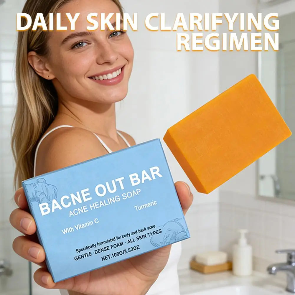 100g Turmeric Hand Made Soap Remove Pimples Anti Acne Whitening Skin Shower & Facial Soap Deep Cleaning For Body Face Skin Care