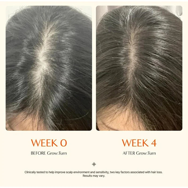 Hair Serum With Built-In Brush,Hair Nourishing Strengthening Essence,Improve Scalp Environment,Scalp Massager,Korean Hair Care
