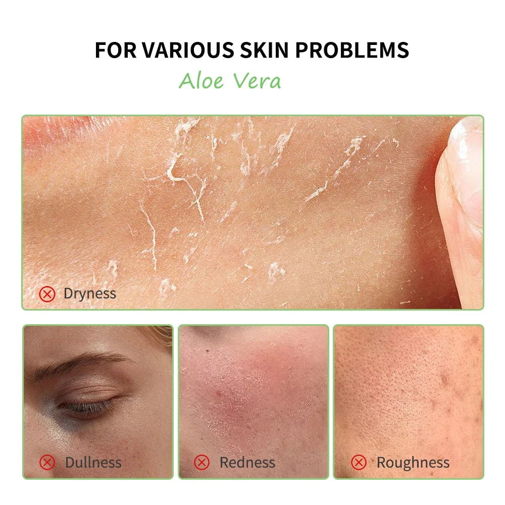 Aloe Vera Gel Lightening Moisturizing Soothing Natural Organic Aloe Vera Gel Reduce Redness Hydrate Exfoliation Skincare