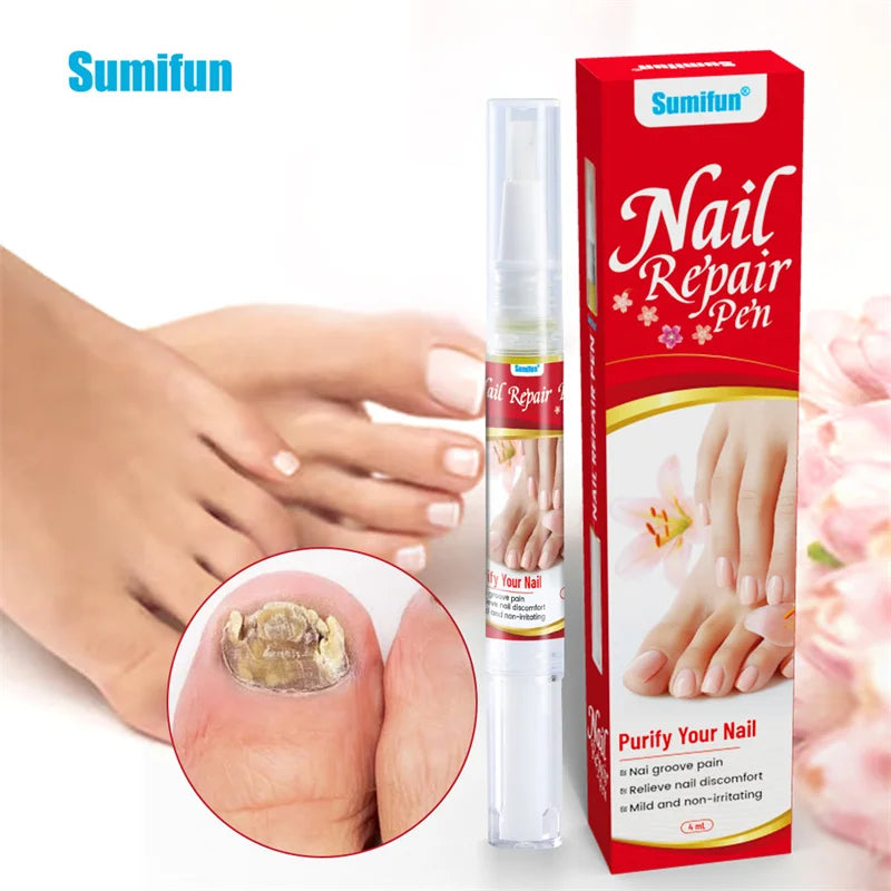 Fungal Nail Treatment Serum Nails Fungus Removal Treating Paronychia Liquid Anti Gray Nails Toe Infection Foot Repair Care Tools