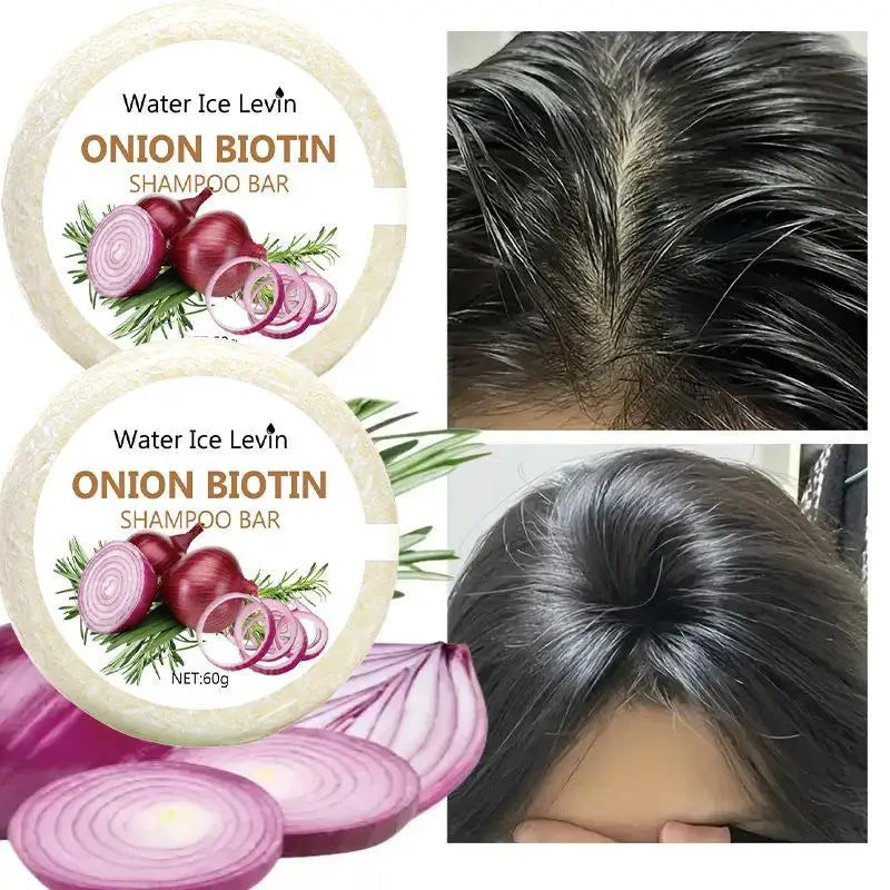 55g/60g Onion Rosemary Shampoo Soap, Handmade Soap Oil Control And Dandruff Removal Soap For Both Men & Women
