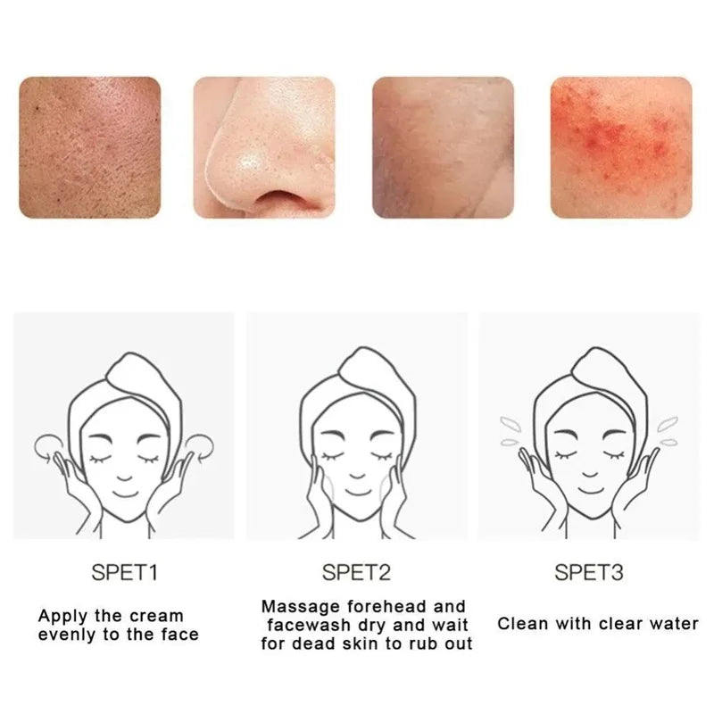 Fruit Acid Peeling Gel Facial Cleansing Exfoliating Peeling Scrub Cream Deep Clean Moisturizing Blackhead Removal Face Cleanser