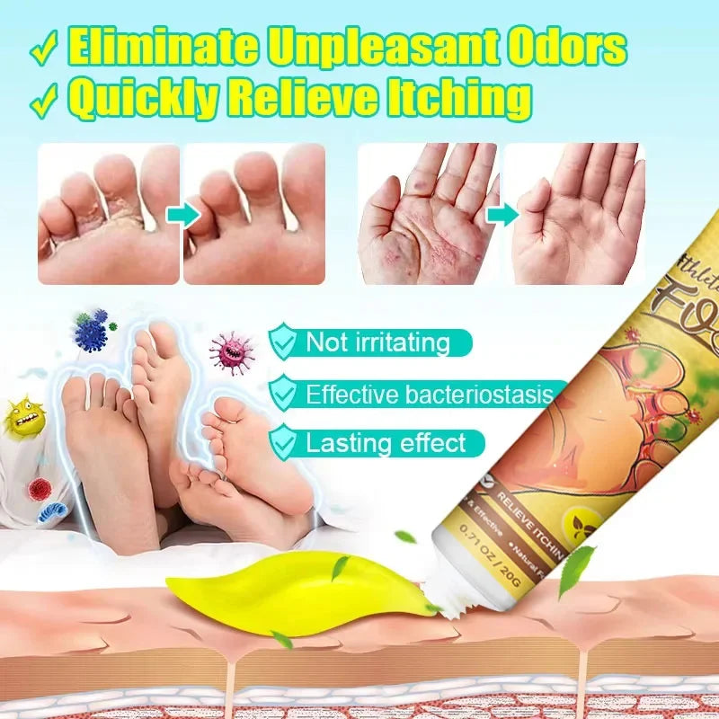 Anti-Foot Fungus Ointment Deodorant Care Products Foot Deodorant Creams Antiseptic and Antiperspirant Foot Skin Topical Cream
