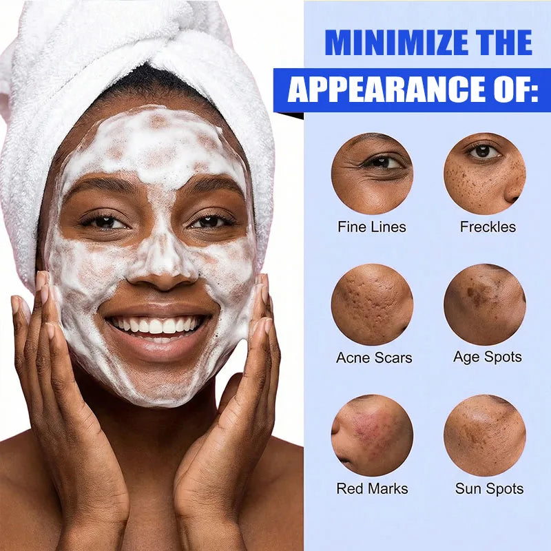 AFCARE Deep Clean Daily Cleanser Mousse Bifida Ferment Lysate Gentle Mouss For Sensitive Skin Refreshingly Soft Lightweight Foam