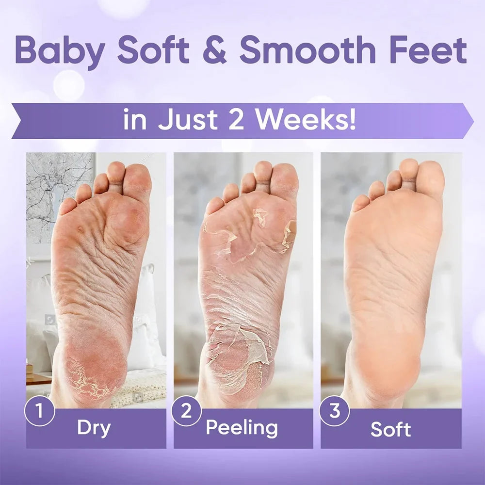 1-20Pair Exfoliating Feet Mask Exfoliating Foot Peel Mask Socks Pedicure Peeling Dead Skin Remover Feet Mask Peel Moisturizing