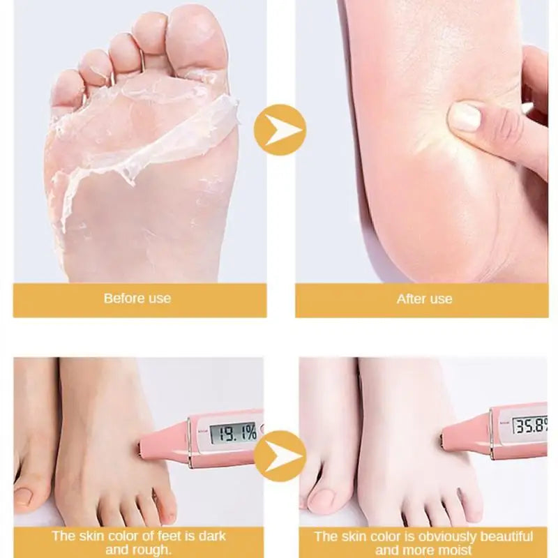 1/3/5 Pairs Goat Milk Exfoliating Foot Mask Feet Pedicure Remove Dead Skin Moisturizing Foot Exfoliator Feet Masks Skin Care