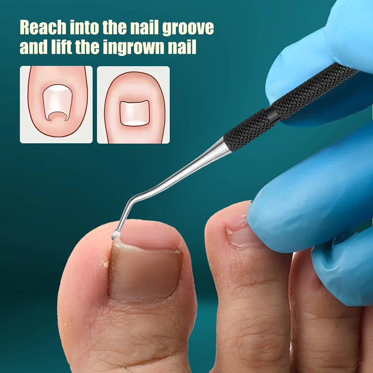 5pcsIngrown Toenail Clipper Set with Beak Pliers,Nail Care Tools for Thick Hard Nails,Stainless Steel Wide-Opening Nail Clippers