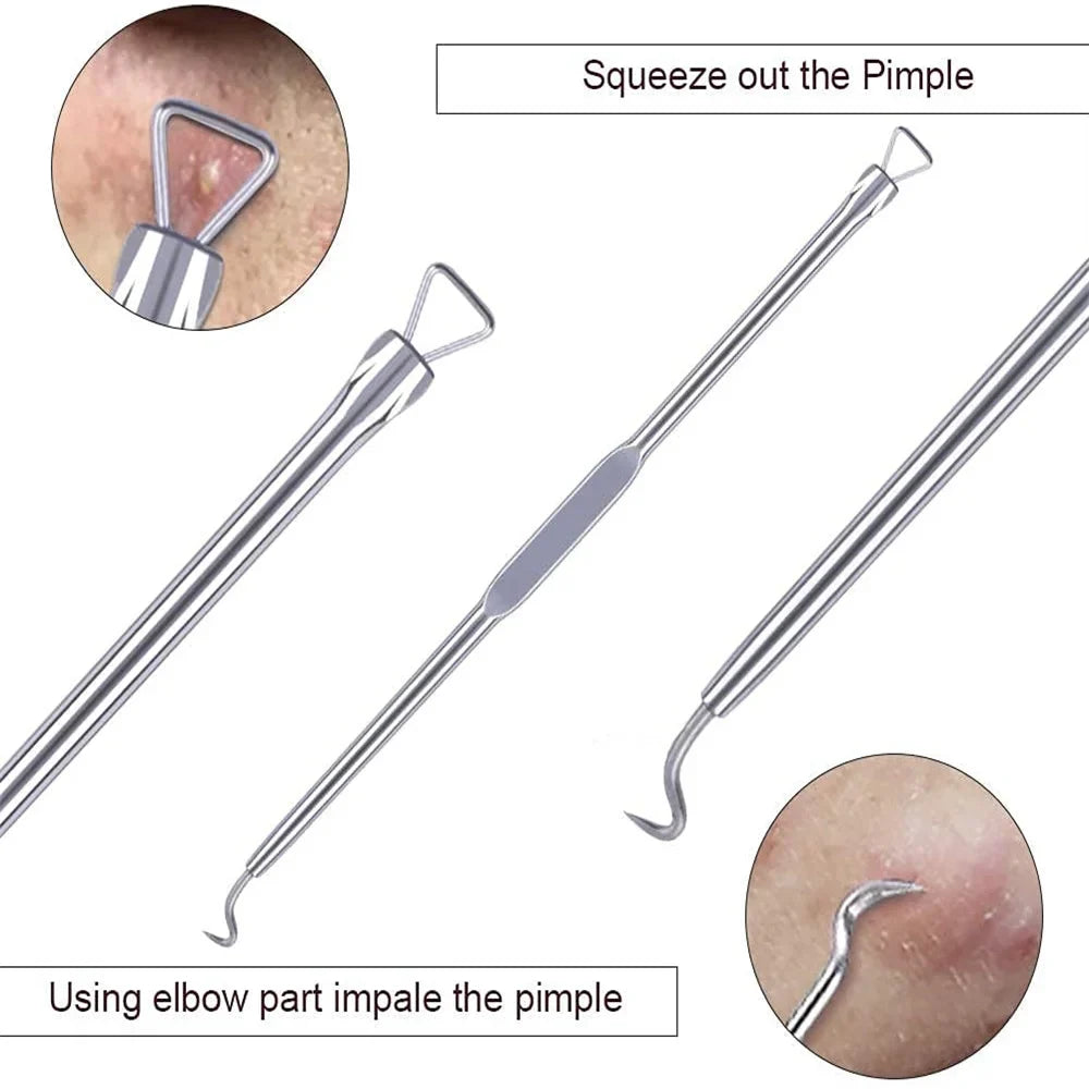 DUcare 4pcs Acne Blackhead Removal Needles Stainless steel Pimple Spot Extractor Acne Treatment Acne Needle Face Clean Care Tool