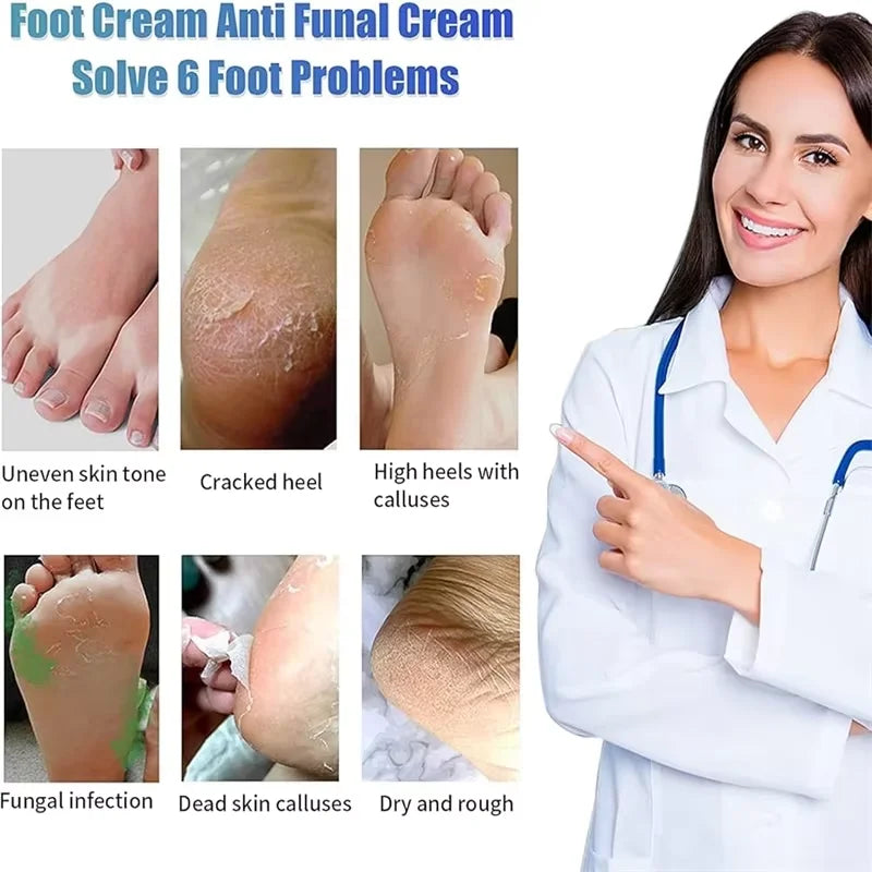 Anti-Foot Fungus Ointment Deodorant Care Products Foot Deodorant Creams Antiseptic and Antiperspirant Foot Skin Topical Cream