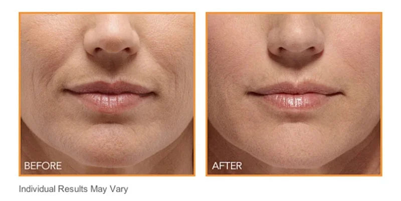 Hydrocrystalline Firming Patch, Anti-aging, Reduces Fine Lines and Facial Sagging, Deep Nourishment, Korean Skincare