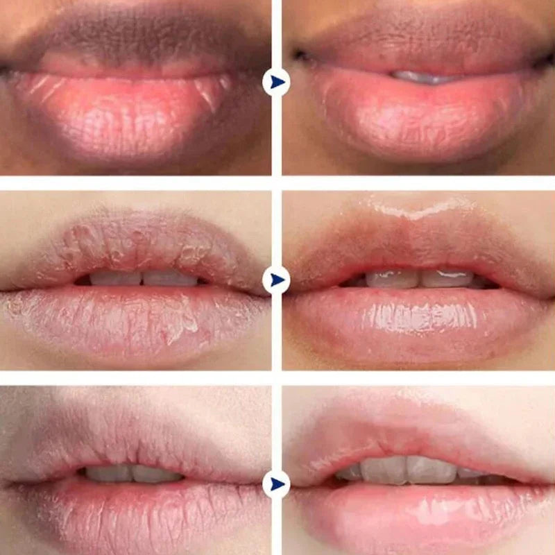 Fast Lightening Pink Mouth Lips Serum Bleaching Permanent Remove Dark Smoke Lips Lip Balm Moisturize Gloss Lipstick Lip Oil