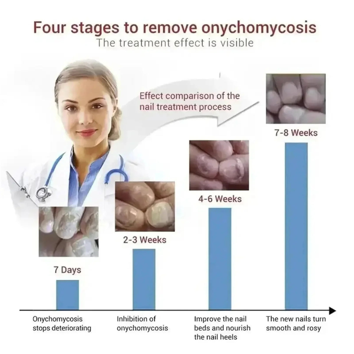 7 Days Fungal Nail Treatment Serum Foot Nail Fungus Removal Repair Gel Anti Infection Paronychia Onychomycosis Foot Nails Care